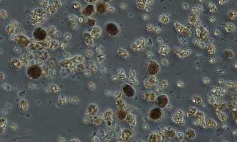 Mikroskopbilde av alge