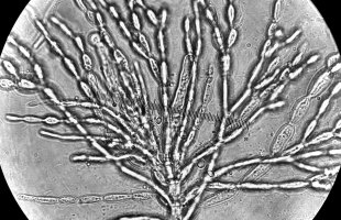 Microscopy picture algae