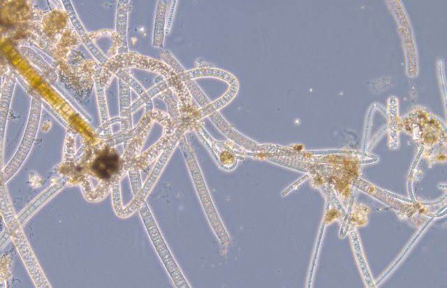 bilde av trådalgen Beggiatoa