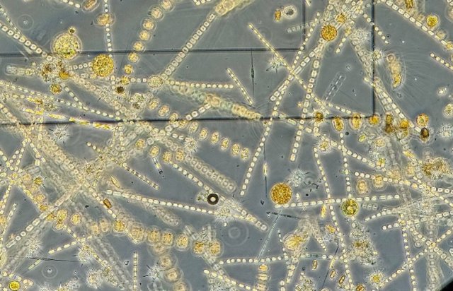 Mikroskopi plankton